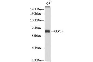 Western blot analysis of extracts of THP-1 cells, using CEP55 antibody (ABIN6127692, ABIN6138423, ABIN6138424 and ABIN6224249) at 1:1000 dilution. (CEP55 Antikörper  (AA 1-260))