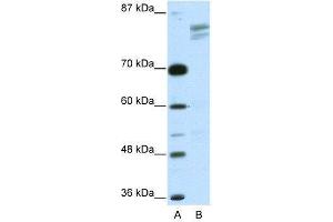 Western Blotting (WB) image for anti-General Transcription Factor III (GTF2I) (N-Term) antibody (ABIN2777491)
