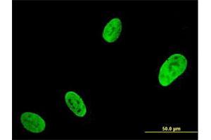 Immunofluorescence of monoclonal antibody to RUNX2 on U-2 OS cell. (RUNX2 Antikörper  (AA 251-350))