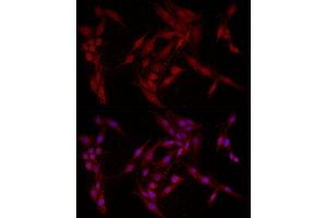 Immunofluorescence analysis of PC-12 cells using F Rabbit pAb (ABIN6127814, ABIN6140422, ABIN6140423 and ABIN6221993) at dilution of 1:200 (40x lens). (FABP5 Antikörper  (AA 1-135))
