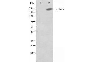 Western blot analysis on K562 cell lysate using Dysferlin Antibody,The lane on the left is treated with the antigen-specific peptide.
