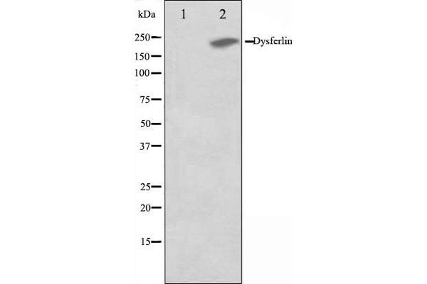 Dysferlin 抗体  (C-Term)
