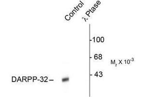 Image no. 1 for anti-Protein Phosphatase 1, Regulatory (Inhibitor) Subunit 1B (PPP1R1B) (pThr34) antibody (ABIN372606) (DARPP32 Antikörper  (pThr34))