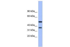 EIF2S1 antibody used at 1 ug/ml to detect target protein. (EIF2S1 Antikörper  (N-Term))