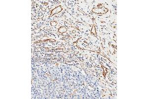 Immunohistochemical analysis of paraffin-embedded human appendix tissue using (ABIN658983 and ABIN2838032) performed on the Leica® BOND RXm. (CD34 Antikörper  (AA 185-214))