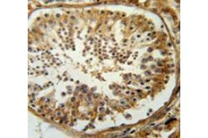 Immunohistochemistry analysis in human testis carcinoma (Formalin-fixed, Paraffin-embedded) using SERAC1  Antibody  (C-term), followed by peroxidase conjugation of the secondary antibody and DAB staining. (SERAC1 Antikörper  (C-Term))