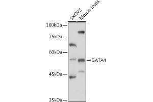 Western blot analysis of extracts of various cell lines, using G antibody (ABIN6133721, ABIN6140975, ABIN6140976 and ABIN6217864) at 1:1000 dilution.