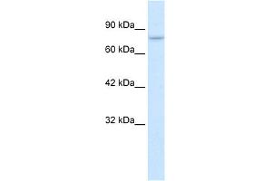 Western Blotting (WB) image for anti-Protein Inhibitor of Activated STAT, 2 (PIAS2) (C-Term) antibody (ABIN2776423)