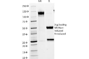SDS-PAGE Analysis Purified VLDL-Receptor Mouse Monoclonal Antibody (VLDLR/1337). (VLDLR Antikörper  (C-Term))