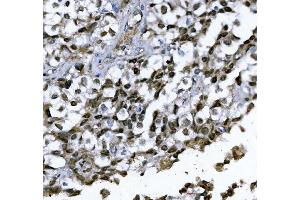 IHC analysis of GATA1 using anti-GATA1 antibody (ABIN7602077).