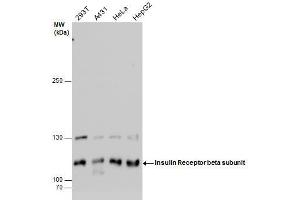 WB Image Insulin Receptor beta subunit antibody detects Insulin Receptor beta subunit protein by western blot analysis. (Insulin Receptor Antikörper  (C-Term))