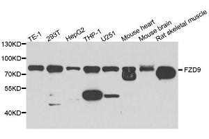Western blot analysis of extracts of various cell lines, using FZD9 antibody. (FZD9 Antikörper  (AA 469-591))