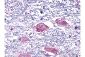Immunohistochemical staining of Brain (Neurons and glia) using anti- PTHR2 antibody ABIN122362 (PTH2R Antikörper  (Extracellular Domain))