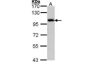 WB Image Sample (30 ug of whole cell lysate) A: Hep G2 , 7. (ADAM15 Antikörper  (N-Term))