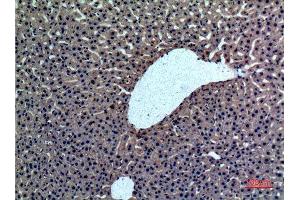 Immunohistochemistry (IHC) analysis of paraffin-embedded Rat liver, antibody was diluted at 1:100. (Prothrombin Antikörper  (Internal Region))
