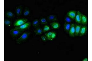 Immunofluorescent analysis of A549 cells using ABIN7171382 at dilution of 1:100 and Alexa Fluor 488-congugated AffiniPure Goat Anti-Rabbit IgG(H+L) (CD3 epsilon Antikörper  (AA 23-126))