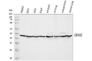 Western blot analysis of eIF4A2 using anti-eIF4A2 antibody (ABIN3043426).