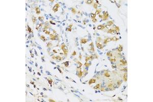 Immunohistochemistry of paraffin-embedded human stomach using RNASE3 antibody. (RNASE3 Antikörper)