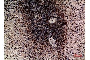 Immunohistochemistry (IHC) image for anti-Leukocyte Immunoglobulin-Like Receptor, Subfamily B (With TM and ITIM Domains), Member 5 (LILRB5) (Internal Region) antibody (ABIN6287603)