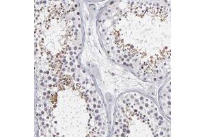 Immunohistochemical staining (Formalin-fixed paraffin-embedded sections) of human testis shows moderate cytoplasmic and nuclear positivity in seminiferous ducts with ODF2 polyclonal antibody . (ODF2 Antikörper  (AA 44-205))