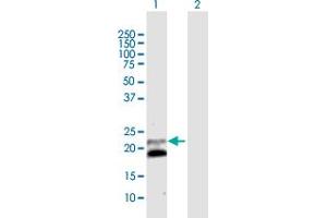 Western Blot analysis of IFNB1 expression in transfected 293T cell line by IFNB1 MaxPab polyclonal antibody. (IFNB1 Antikörper  (AA 1-187))