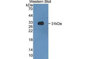 Detection of Recombinant CCDC60, Mouse using Polyclonal Antibody to Coiled Coil Domain Containing Protein 60 (CCDC60) (CCDC60 Antikörper  (AA 1-186))