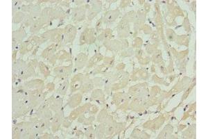 Immunohistochemistry of paraffin-embedded human heart tissue using ABIN7157743 at dilution of 1:100 (KCNIP2 Antikörper  (AA 1-90))