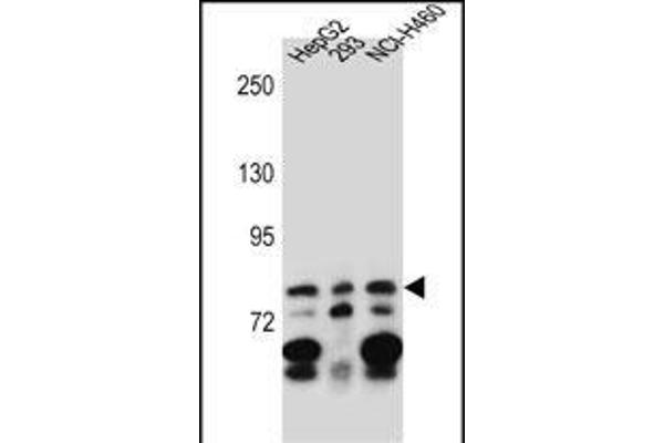 ZNF555 Antikörper  (C-Term)