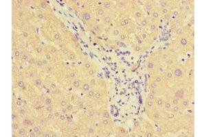 Immunohistochemistry of paraffin-embedded human liver tissue using ABIN7170841 at dilution of 1:100 (SMAP1 Antikörper  (AA 1-280))