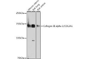 Western blot analysis of extracts of various cell lines, using Collagen III alpha 1/COL3 antibody (ABIN7266459) at 1:1000 dilution. (COL3 Antikörper)