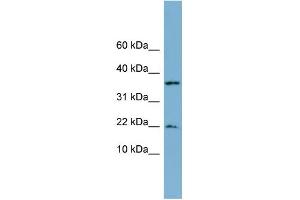 WB Suggested Anti-DUSP10 Antibody Titration: 0. (DUSP10 Antikörper  (N-Term))