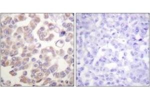 Immunohistochemistry (Paraffin-embedded Sections) (IHC (p)) image for anti-Wingless-Type MMTV Integration Site Family, Member 1 (WNT1) (AA 301-350) antibody (ABIN1533461)