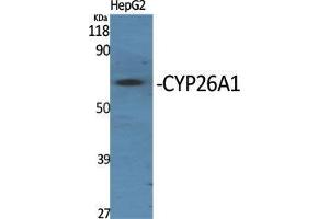 Western Blot (WB) analysis of specific cells using CYP26A1 Polyclonal Antibody. (CYP26A1 Antikörper  (Internal Region))