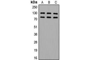 Western blot analysis of Alpha-adducin (pS726/713) expression in HeLa (A), SP2/0 (B), PC12 (C) whole cell lysates. (alpha Adducin Antikörper  (C-Term, pSer713, pSer726))