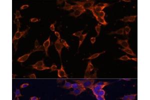 Immunofluorescence analysis of NIH-3T3 cells using USP36 Polyclonal Antibody at dilution of 1:100 (40x lens). (USP36 Antikörper)