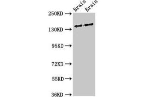 Western Blot Positive WB detected in: Rat brain tissue, Mouse brain tissue All lanes: MAST3 antibody at 3 μg/mL Secondary Goat polyclonal to rabbit IgG at 1/50000 dilution Predicted band size: 144 kDa Observed band size: 144 kDa
