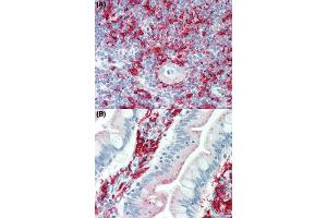 Immunohistochemical staining (Formalin-fixed paraffin-embedded sections) of human thymus tissue (A) and human small intestine tissue (B) using HLA Class II beta chains (DP, DQ, DR) monoclonal antibody, clone WR18  under 10 ug/mL working concentration.