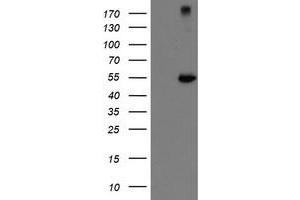 Western Blotting (WB) image for anti-rho GTPase Activating Protein 2 (ARHGAP2) antibody (ABIN1499629)