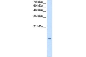Western Blotting (WB) image for anti-Microsomal Glutathione S-Transferase 2 (MGST2) antibody (ABIN2462839) (MGST2 Antikörper)