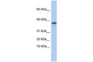 GLYAT antibody used at 1 ug/ml to detect target protein.