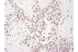 Immunohistochemistry (IHC) image for anti-Methyl-CpG Binding Domain Protein 2 (MBD2) (AA 361-411) antibody (ABIN7453726)