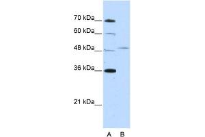 WB Suggested Anti-FOXQ1 Antibody Titration:  2.