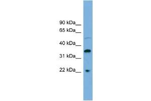 WB Suggested Anti-DOK6 Antibody Titration: 0. (DOK6 Antikörper  (Middle Region))