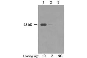 Primary antibody: 1 µg/mL Mouse Anti-Enterokinase Monoclonal Antibody (ABIN398568) Secondary antibody: Goat Anti-Mouse IgG (H&L) [HRP] Polyclonal Antibody (ABIN398387, 1: 20,000) The signal was developed with LumiSensorTM HRP Substrate Kit (ABIN769939)