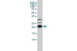 RHOJ monoclonal antibody (M01), clone 1E4 Western Blot analysis of RHOJ expression in HepG2 (RHOJ Antikörper  (AA 1-214))