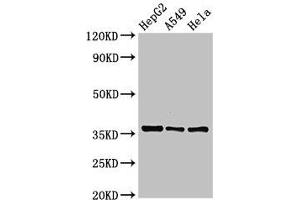 Western Blot Positive WB detected in: HepG2 whole cell lysate, A549 whole cell lysate, Hela whole cell lysate All lanes: ECH1 antibody at 2.