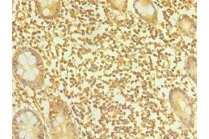 Immunohistochemistry of paraffin-embedded human small intestine tissue using ABIN7164899 at dilution of 1:100 (TAC1 Antikörper  (AA 1-129))