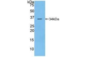 Western Blotting (WB) image for anti-Protein tyrosine Phosphatase, Receptor Type, J (PTPRJ) (AA 567-842) antibody (ABIN7441778)