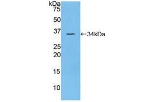 Detection of Recombinant DEP1, Mouse using Polyclonal Antibody to Density Enhanced Phosphatase 1 (DEP1) (PTPRJ Antikörper  (AA 567-842))