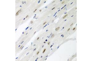 Immunohistochemistry of paraffin-embedded mouse heart using CDC27 antibody (ABIN5975347) at dilution of 1/200 (40x lens). (CDC27 Antikörper)